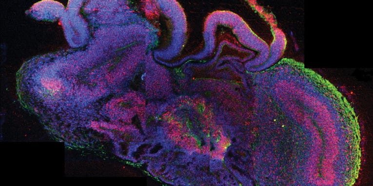 Whoa! Scientists Grow A Brain In A Dish