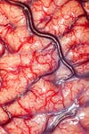 This photograph shows the cortex of a human brain belonging to an epileptic patient. It was taken before an intracranial electrode procedure to treat the patient's epilepsy. After removal of several brain sections, this patient made a full recovery and no longer suffers from seizures. Judges chose it as the overall winner because of its detail. From judge Alice Robert explains: "The 'gray' matter (which is gray in death) is blushing pink. Small arteries are glowing with the scarlet blood pulsing through them, while purple veins lie thickly in the sulci, the crevices of the brain. And underneath that is somebody's mind." See the other winners in the <a href="http://www.wellcomeimageawards.org/index.htm">full gallery over at the Wellcome Trust</a>.