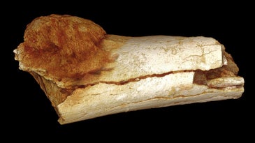 Tumor In Ancient Foot Bone Suggests Paleo Diet Overrated