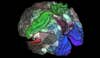 new map of the cerebral cortex of the human brain