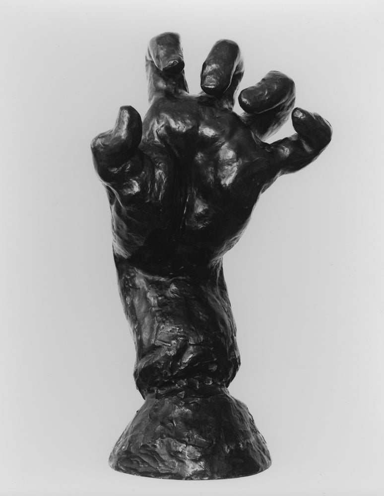 Rodin's bronze Clenched Left Hand looks similar to a patient with Charcot-Marie-Tooth disease, a neurological disorder that causes weakness in the hands and muscle atrophy."I see pain and anguish and stress in the hands," Chang said. "As a hand surgeon and an anatomist it's challenging to unravel the different imbalances between tendons and nerves that would have to occur to create that type of posture in the hand."