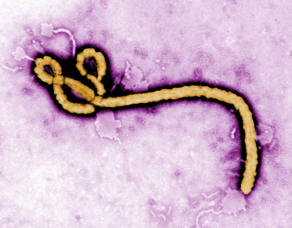 "Ebola