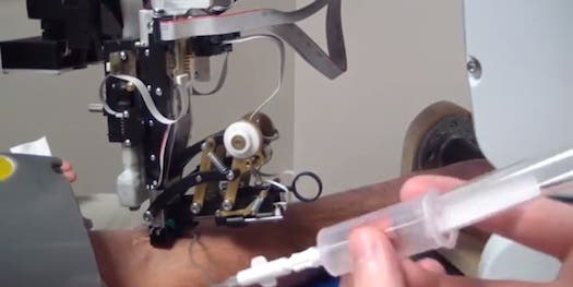 Blood-Sample Robot Misses Veins About As Often As Trained Humans Do