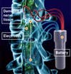 There´s good news for those recently paralyzed by spinal-cord injuries. A small battery-powered device inserted beside the spinal column within 18 days of an injury can stimulate the regrowth of nerve tissue. The device, made by Cyberkinetics in Massachusetts, has helped both newly paralyzed dogs and humans regain some movement.