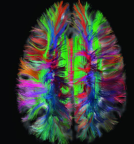 Diffusion spectrum MRI (DSI) of major fiber pathways in the brain of a human adult. This image shows pathways that cross a horizontal slice through the center of the brain as seen from above, representing about 10% of the total in this scan. The frontal lobes are at top, and visual areas at bottom (, and for clarity each path is color-coded according to its overall directions). The large horizontal red band deep in the center is the major connection between the left and right hemispheres (, the corpus callosum), and the green vertical bands at center (, the cingulum bundles,) form a part of the “core” circuitry of higher mental function.