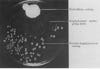 In 1928, when his staphylococcus culture plate became infested with mold, <a href="http://www.pbs.org/wgbh/aso/databank/entries/bmflem.html">Alexander Fleming</a> noticed that the bacteria wasn't growing around the mold, as shown in this image. Further experiments showed that the mold was effective against bacteria, even when diluted 800 percent. This compound, which came from the <em>penicillium notatum</em> mold, he named penicillin. He shares a <a href="http://nobelprize.org/nobel_prizes/medicine/laureates/1945/fleming-bio.html#">Nobel Prize in Medicine</a> with Howard Florey and Ernst Chain, two scientists who worked with penicillin during World War II.