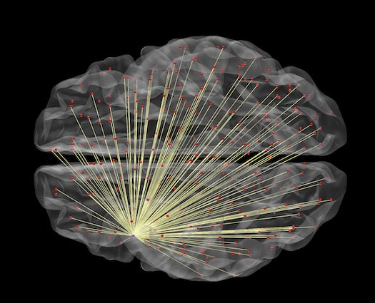 The Best Way to Measure Intelligence Could Be Brain Imaging