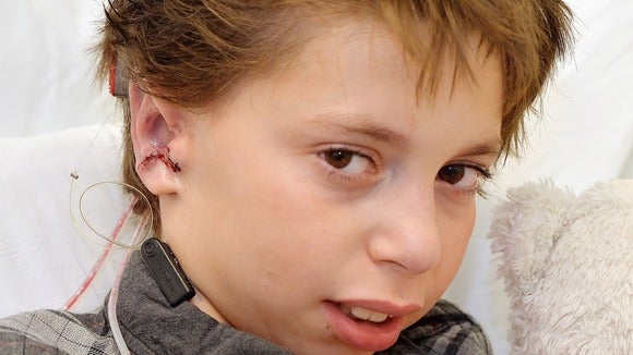Nine-year-old Kieran Sorkin was having trouble making friends at school. "I want people to stop asking me questions," he told <a href="http://www.bbc.com/news/health-28746868">the BBC</a>. Other students kept asking him about his ears, which were deformed due to a congenital condition called <a href="http://www.microtia.net/">microtia</a>. So a surgical team in London removed cartilage from his ribs and used it to fashion new ears for him. Although Sorkin still needs hearing aids, the psychological impacts of the operation can be huge, giving him more confidence for the rest of his life.