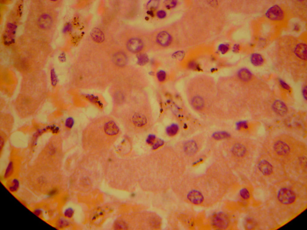 Plasmodium malariae, a malaria parasite, in the liver.