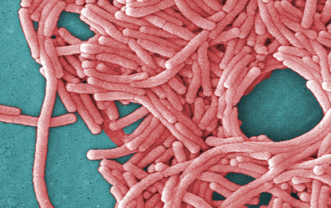 Better Know A Plague: Legionnaires’ Disease