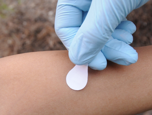 Vaccine Patches For Measles Could Be Here By 2017