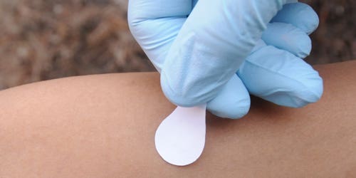 Vaccine Patches For Measles Could Be Here By 2017