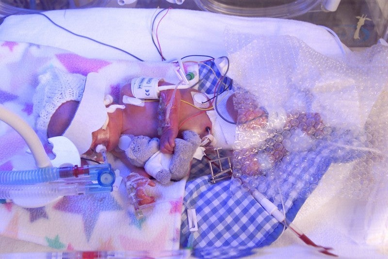 Medical equipment surrounds this premature baby in an incubator. A ventilator allows the neonate to breathe efficiently while a monitor checks the oxygen concentration in the bloodstream. Other monitoring apparatus ensures that the heart rate remains constant. Central lines allow the easy administration of fluids and medication through the navel, and the neonate can receive necessary antibiotics through blood vessels in the arm. [<a href="http://www.wellcomeimageawards.org">Wellcome Image Awards</a>]