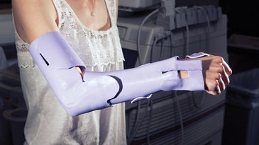 2012 Invention Awards: A Recovery-Accelerating Modular Cast