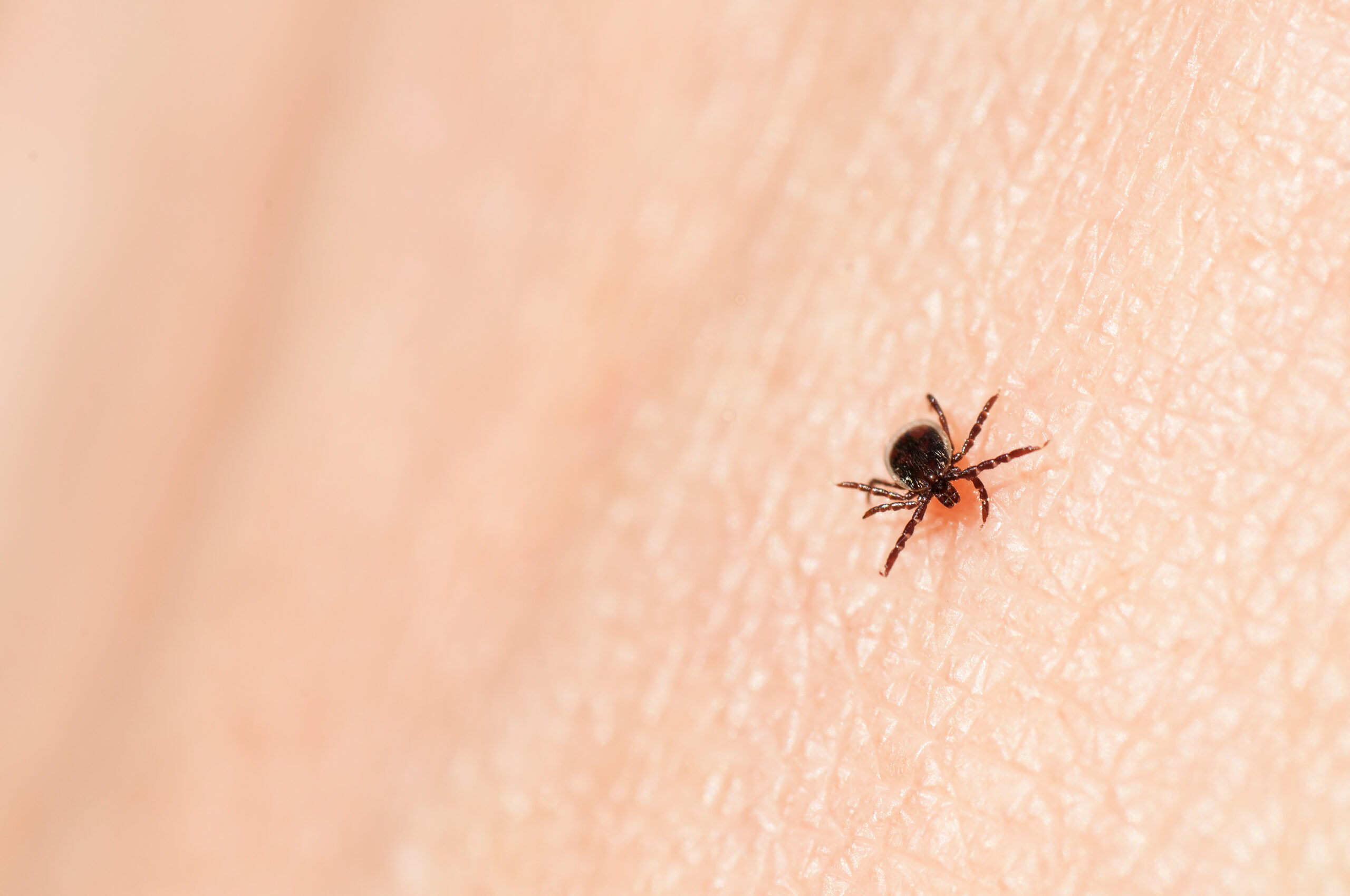 You’re less likely to get a tick bite if you steer clear of these spots