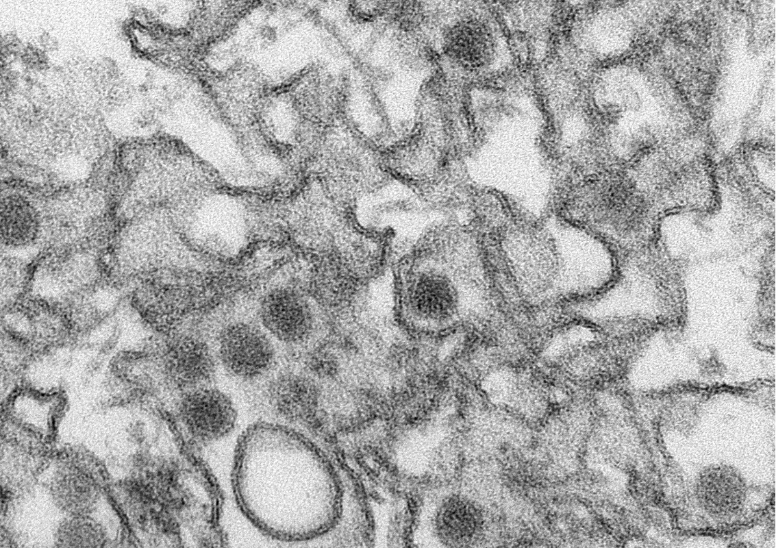 U.S. Confirms First Case Of Zika Virus Transmitted Through Sex