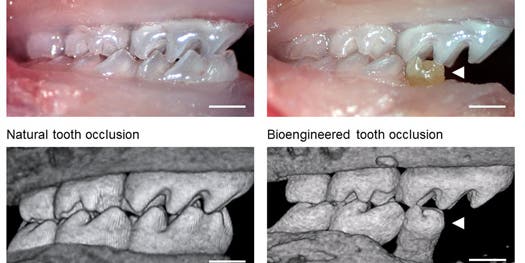 Mice Molars Grown From Stem Cells Form Fully Functional, Transplantable Teeth