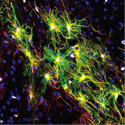 The yellow-green areas are human astrocytes and the blue spots are mouse cell nuclei.