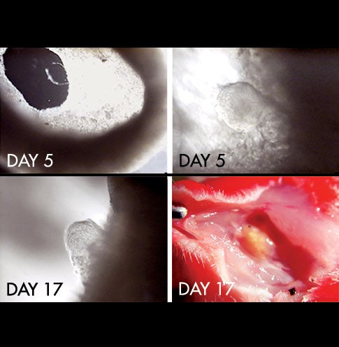 Inside a doughnut-shaped artificial womb, a mouse embryo adheres to uterine tissue by Day 5. By Day 14, the embryo has invaded the tissue and its cells are becoming specialized. By Day 17, a mouse fetus is visible developing inside a well-formed yolk sac. A fully formed fetus also developed by Day 17 in an experiment in which the artificial womb was transferred to a surrogate mother.