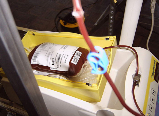 Transfusion of Synthetic Blood Saves Woman’s Life