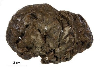 800-Year-Old Fossilized Brain Found Containing Intact Remnants of Brain Cells