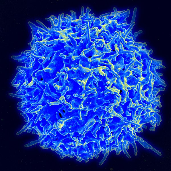 Scientists Tweak T Cells Using CRISPR