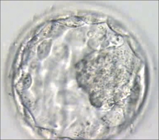Scientists Create First Cloned Human Embryo