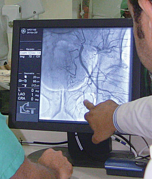 Doctors use an x-ray imaging screen to guide the catheter into position.
