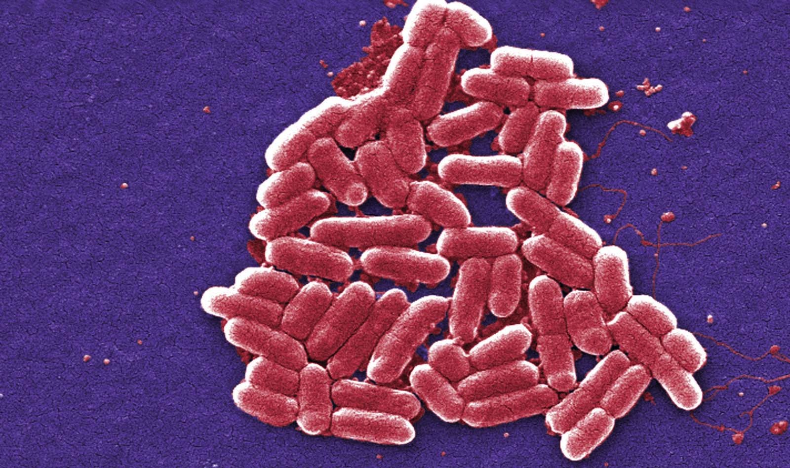 Your DNA Could Make You Resistant To Certain Bacteria