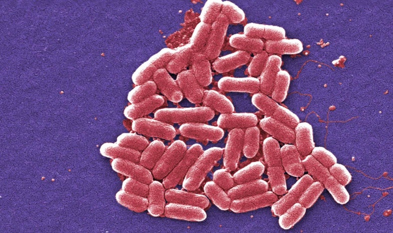 2006 National Escherichia, Shigella, Vibrio Reference Unit at CDC Under a magnification of 6836x, this colorized scanning electron micrograph (SEM) depicted a number of Gram-negative Escherichia coli bacteria of the strain O157:H7, which is one of hundreds of strains of this bacterium. Although most strains are harmless, and live in the intestines of healthy humans and animals, this strain produces a powerful toxin, which can cause severe illness.E. coli O157:H7 was first recognized as a cause of illness in 1982 during an outbreak of severe bloody diarrhea; the outbreak was traced to contaminated hamburgers. Since then, most infections have come from eating undercooked ground beef.The combination of letters and numbers in the name of the bacterium refers to the specific markers found on its surface, which distinguishes it from other types of E. coli. See PHIL 8800 for a black and white version of this image. Escherichia coli O157:H7 is an emerging cause of foodborne illnes