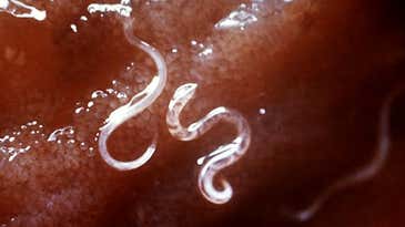 Bloodsucking Hookworms May Provide A Treatment For Asthma