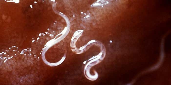 Bloodsucking Hookworms May Provide A Treatment For Asthma
