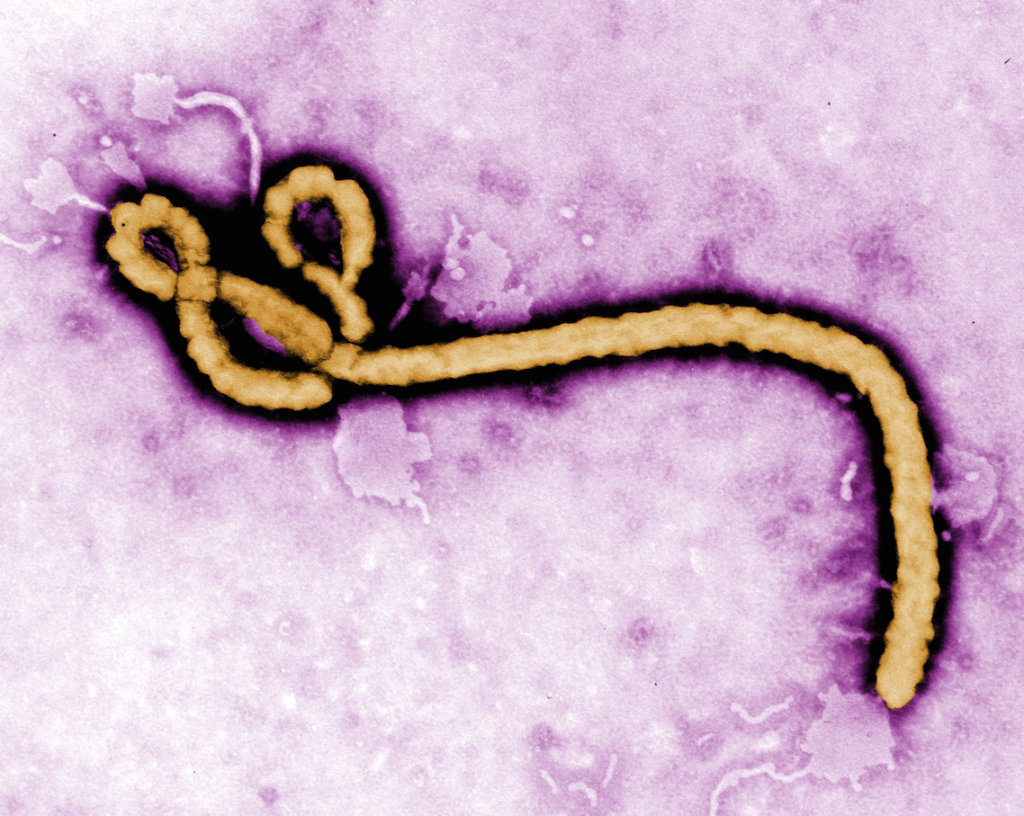 "Ebola