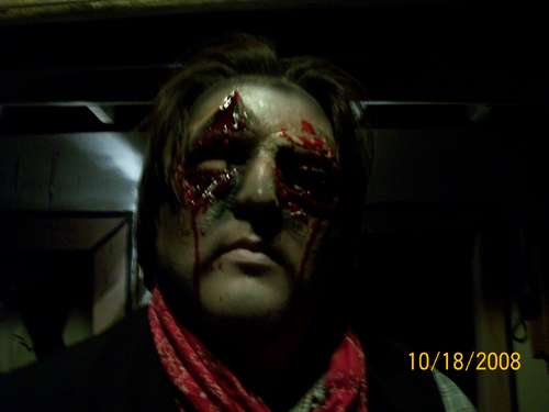 A realistic facial prosthesis Halloween costume of a man with gouged-out eyes.