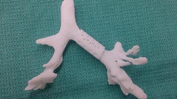 This 3-D Printed Bioplastic Windpipe Saved A Baby’s Life