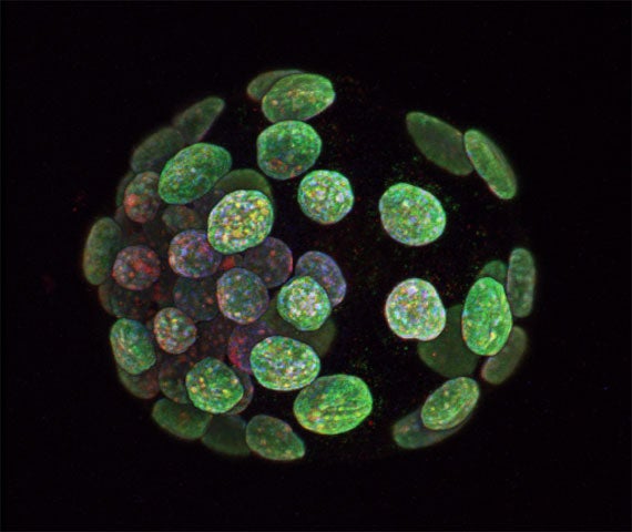 A blastocyst is an embryo so young that it hasn't yet implanted into the uterine wall; it's just a ball of undifferentiated cells. In both mice and humans, embryonic stem cells are extracted from the core of the blastocyst (the outer cells will eventually become placenta)—in fact, it was by experimenting on mouse embryos over 20 years ago that scientists figured out how to isolate stem cells in the first place.