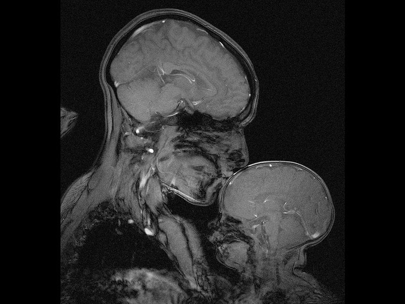 MRI Of Mother And Child