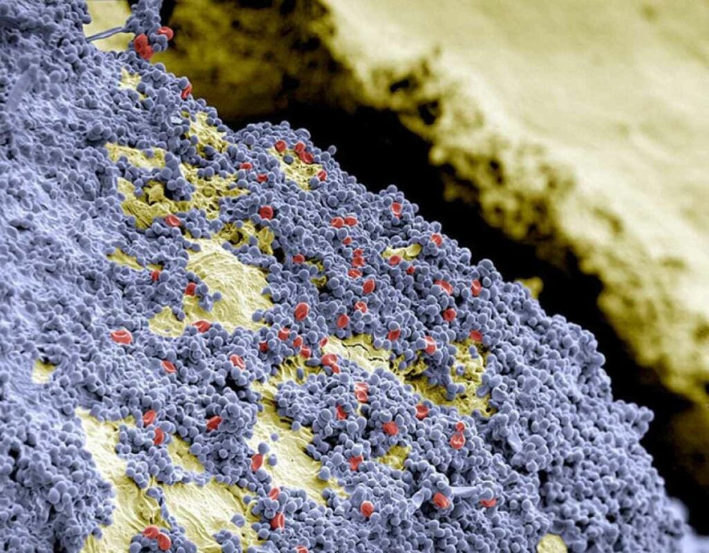 The human mouth is home to over 300 species of bacteria. The yellow surface of a human tooth is seen up-close and personal in a colored scanning electron micrograph, blanketed in blue-colored bacteria and red blood cells. <a href="https://www.popsci.com/galaxys-magnetic-field-insect-flight-paths-and-other-amazing-images-week/"><em>From December 7, 2014</em></a>