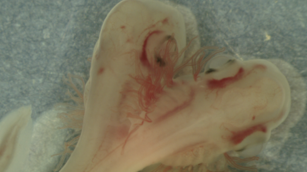 A double shark embryo