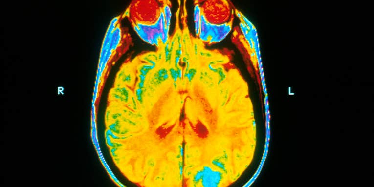 Largest-Ever Medical Imaging Study Launches In The UK