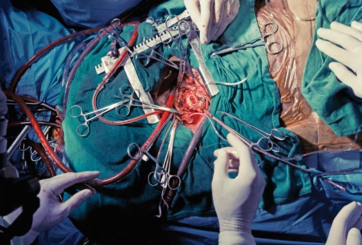 Human heart flow state in the operating room.
