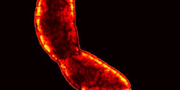 Video Microscopy Unveils the Tricks of Nature’s Toughest Glue, Oozed By a Bacterium