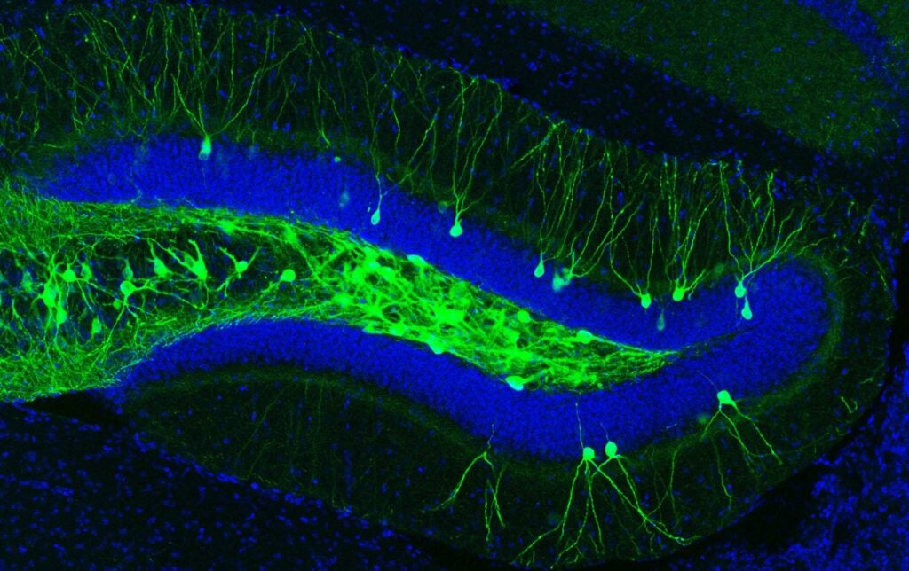 A section of the mouse's dentate gyrus