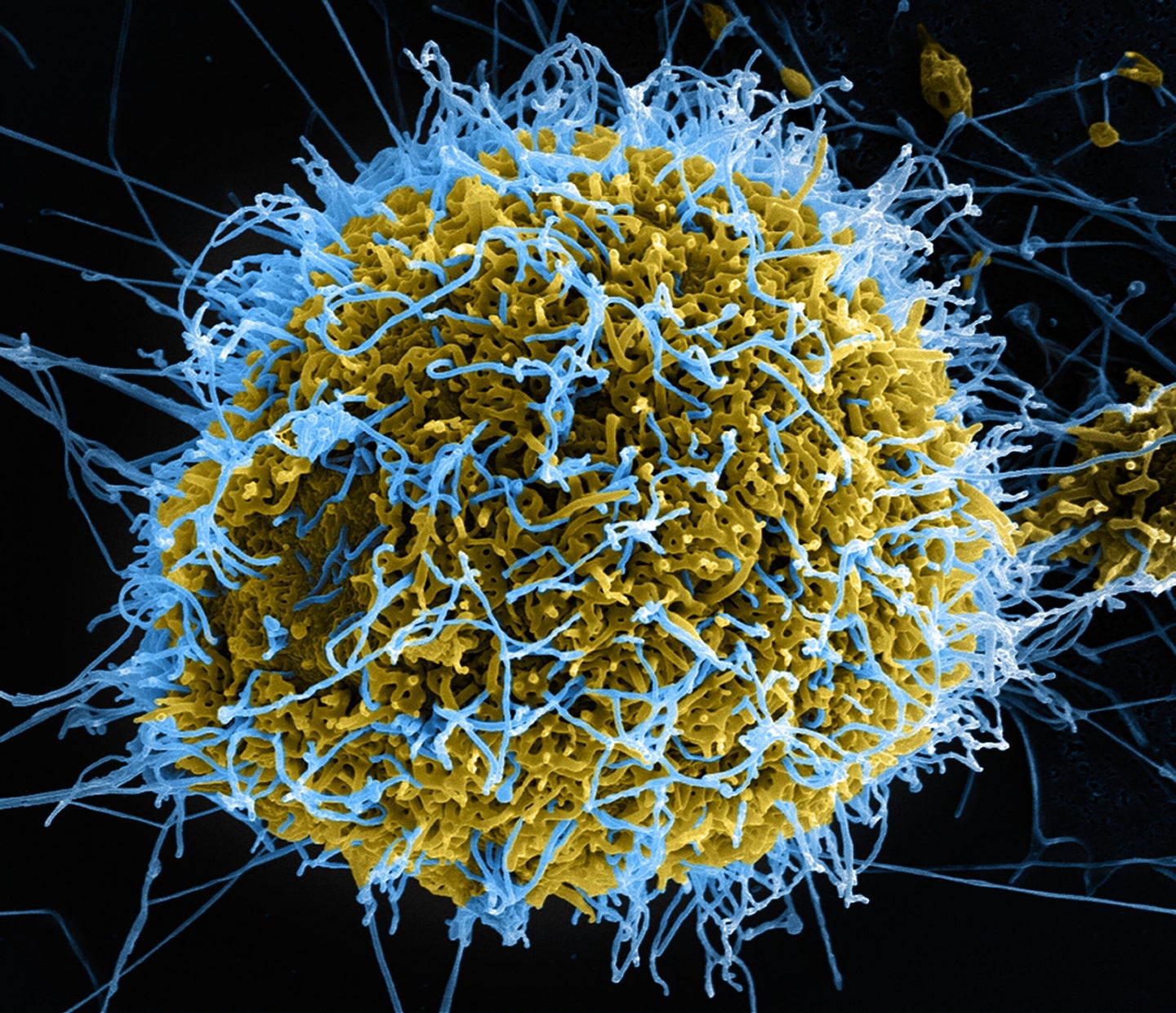 Colorized scanning electron micrograph of filamentous Ebola virus particles (blue) budding from a chronically infected VERO E6 cell (yellow-green).