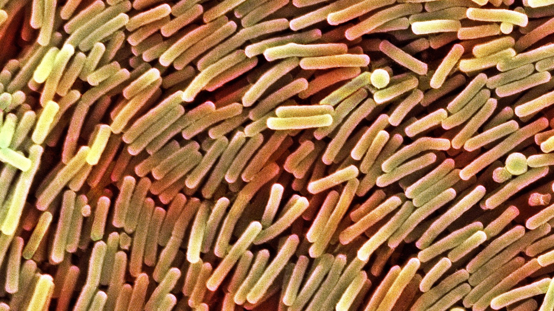 Clostridium difficile Is More Common Than You Think