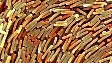 Clostridium difficile Is More Common Than You Think