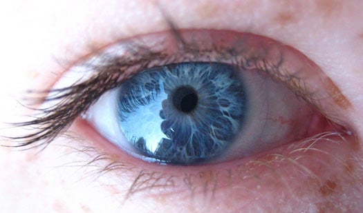 Doctor Offers Laser Treatment to Permanently Make Brown Eyes Blue