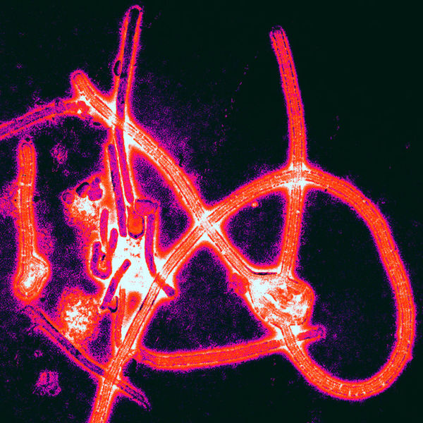 Why Ebola Isn’t A ‘Global Health Emergency’–At Least Not In The Way You Might Think