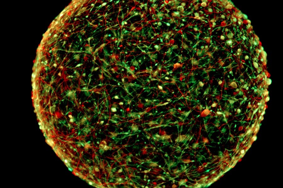 These tiny mini-brains contain all the cell types found in a real brain.