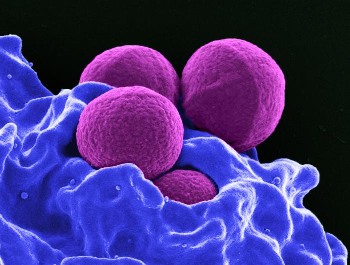 "Staphylococcus